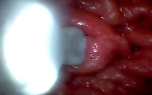 Hotwife Shows Her Tight Pussy and Big Clit in an Intimate Endoscope Photo Shoot